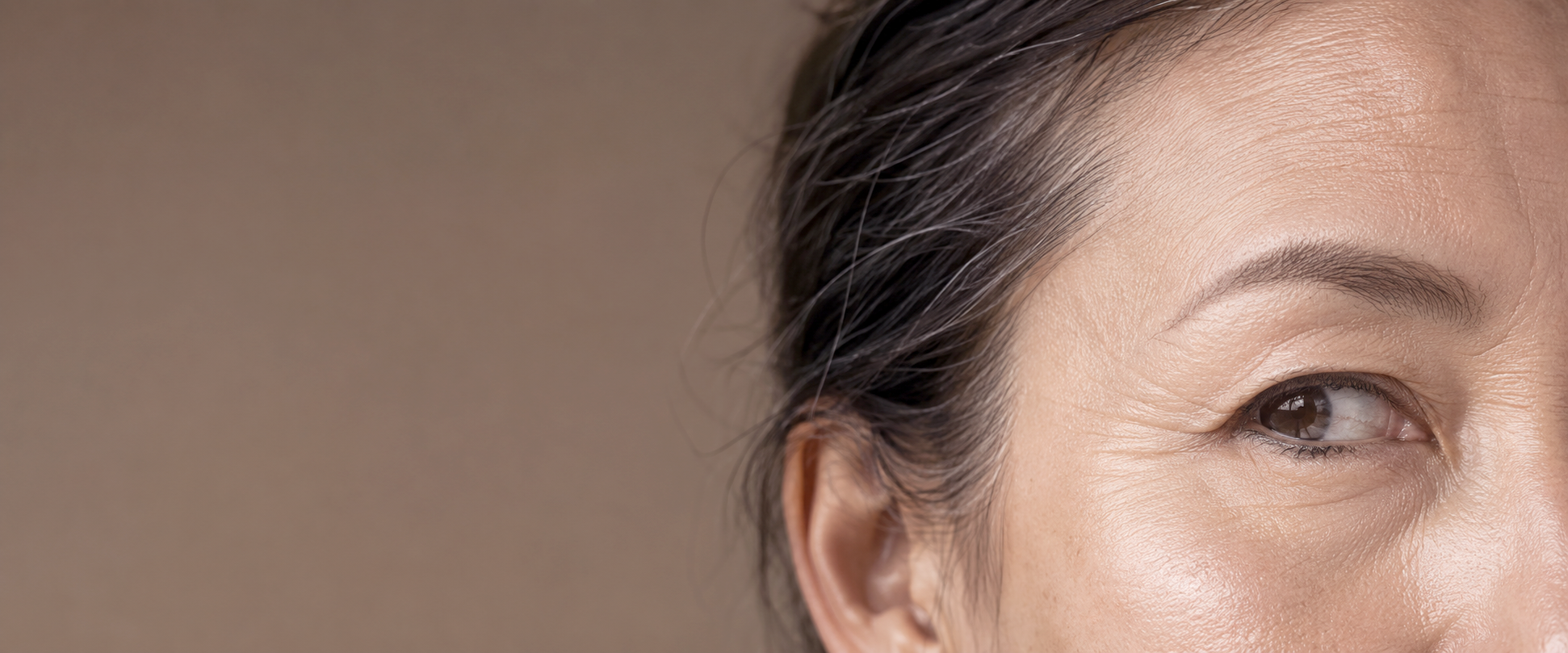 Fine lines & Wrinkles Concerns.png