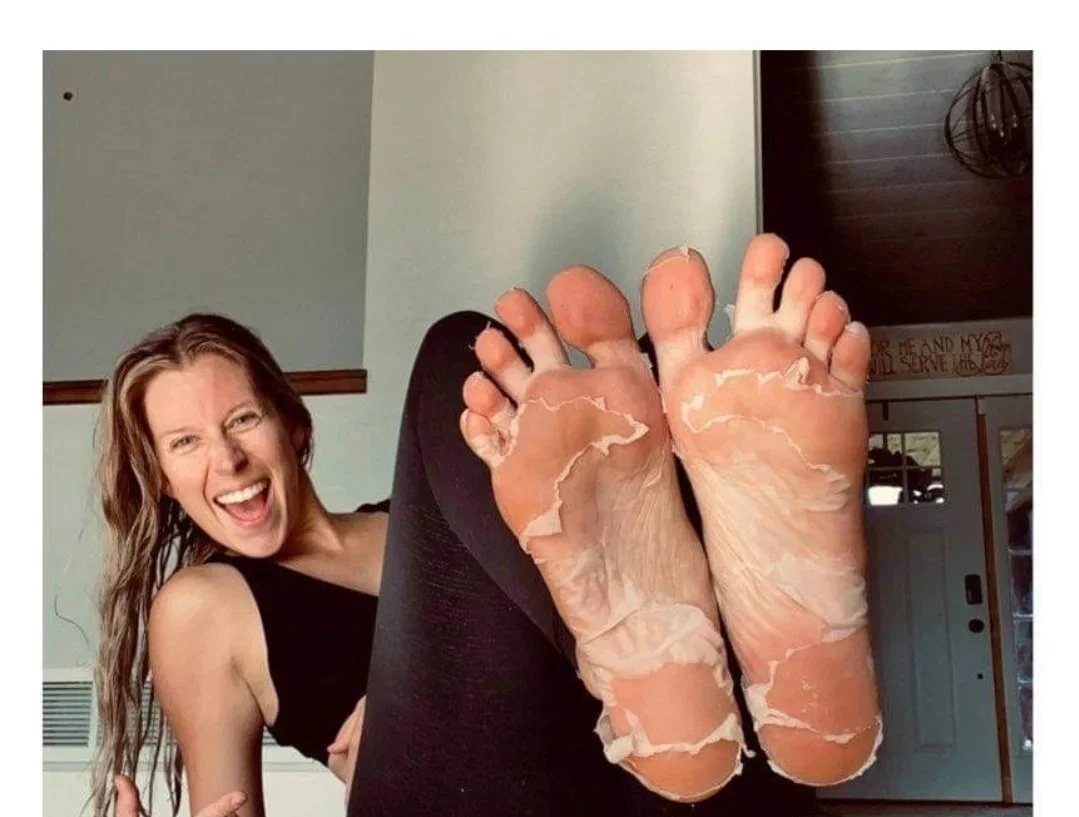 exfoliating-foot-peels-135787.jpg