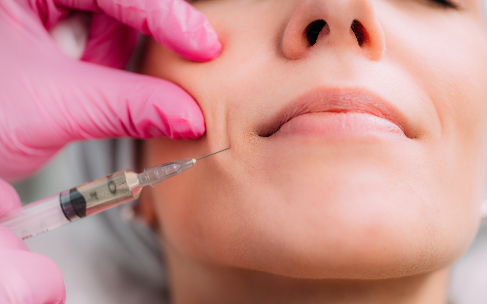 Medspa in MIdland, TX, 79701 | Fillers Me.png