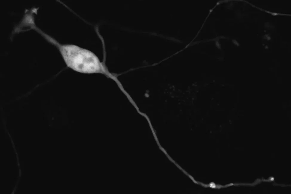 An olfactory neuron in culture with a cell body and multiple long, thin dendrites extending in different directions, set against a dark background.