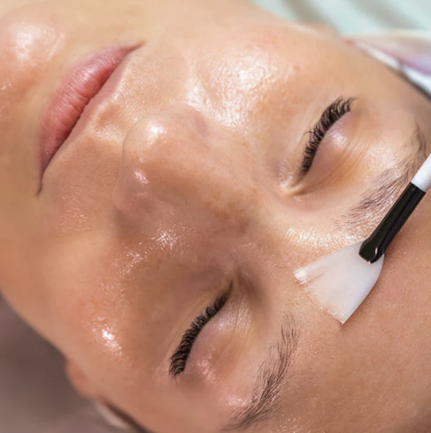 Medspa in Manchester, MI, 48158 | Peels Near Me