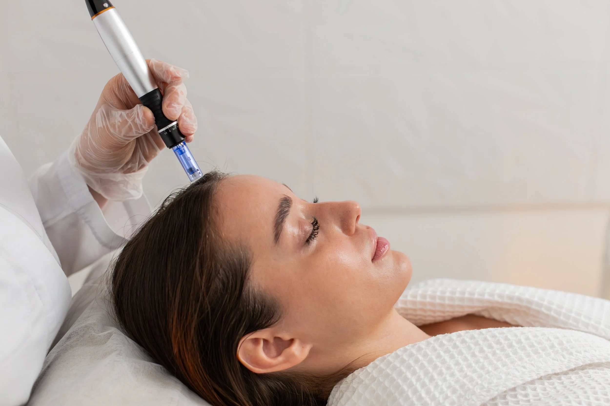 Medspa in La Jolla, CA, 92037 Microneedling Near Me
