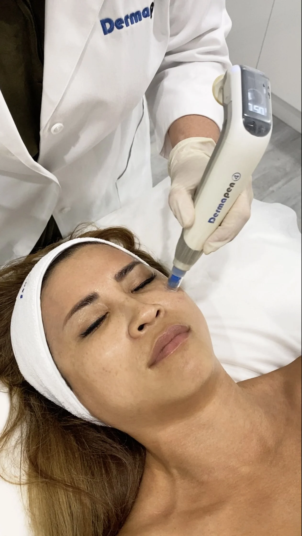 Dermapen 4 microneedling facial treatment at Lumirae Clinic in Henley Beach, Adelaide. personalised skin treatment plans