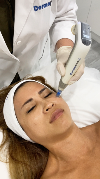Dermapen 4 ATP Signature