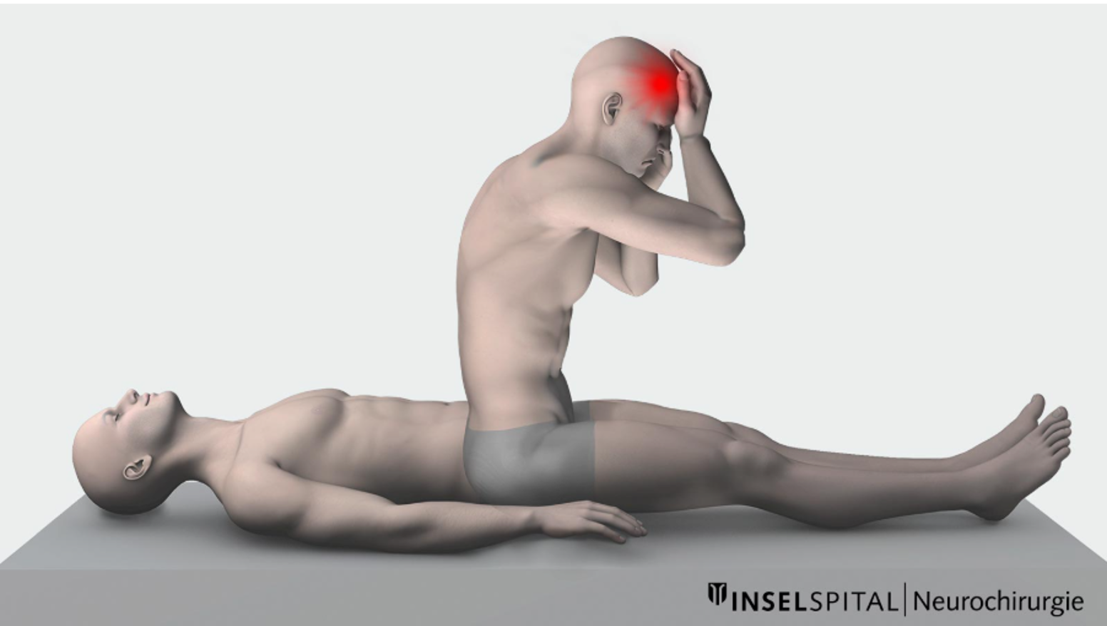 Une illustration médicale montrant une personne allongée sur le dos et une autre en position de pliage de genoux, semblant effectuer un massage ou une thérapie crânienne. L'image met en évidence une zone en rouge sur le front de la personne en position assise, indiquant une douleur ou une tension crânienne. Le texte en bas à droite indique 'INSELSPIAL | Neurochirurgie'.