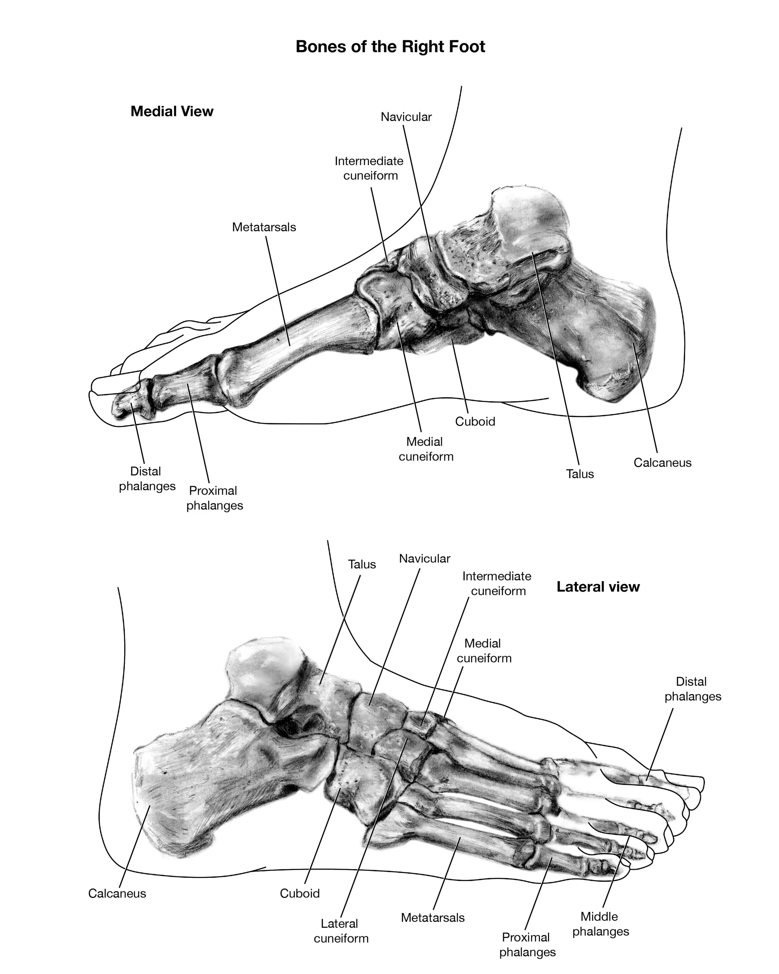 Diagram of the bones of the right foot showing medial view and lateral view with labels for bones such as navicular, intermediate cuneiform, medial cuneiform, cuboid, talus, calcaneus, distal phalanges, proximal phalanges, lateral cuneiform, metatarsals, and middle phalanges.