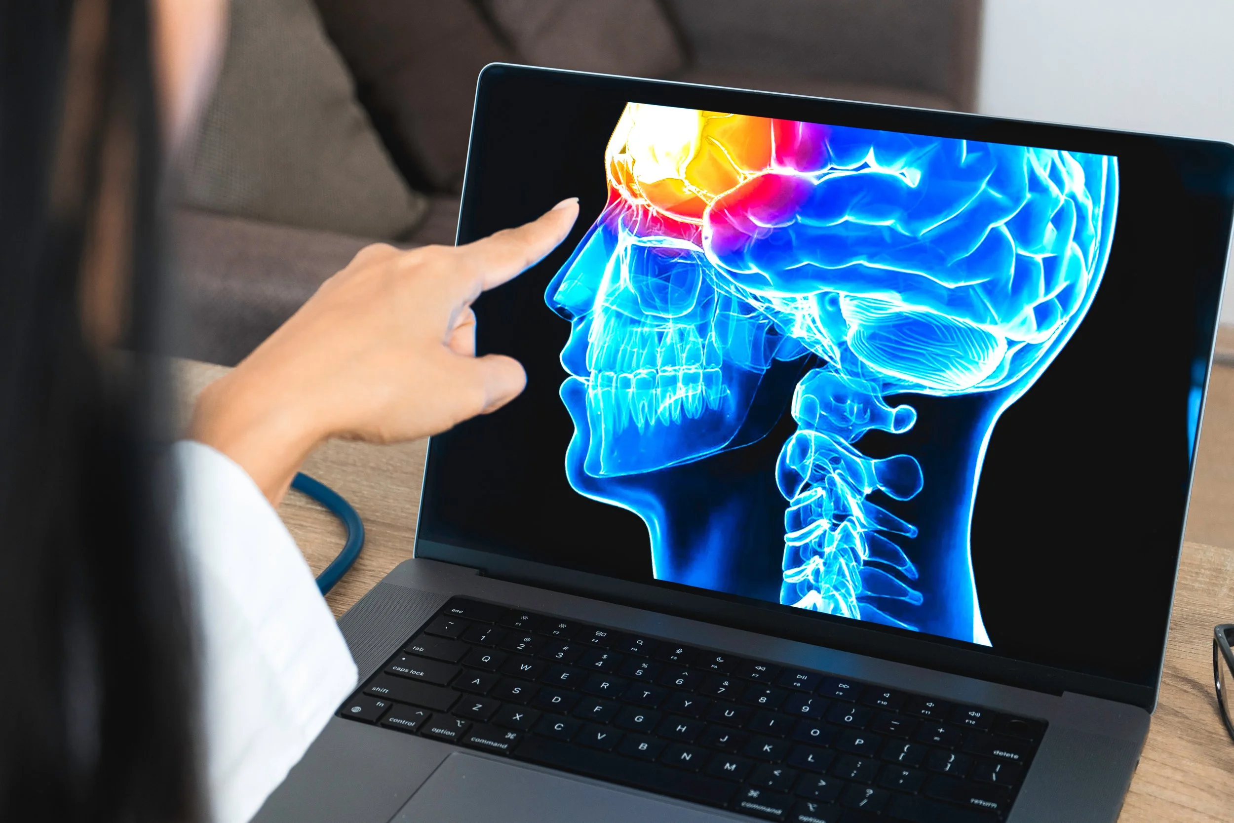 There's Nothing Mild About a Mild Traumatic Brain Injury (mTBI)
