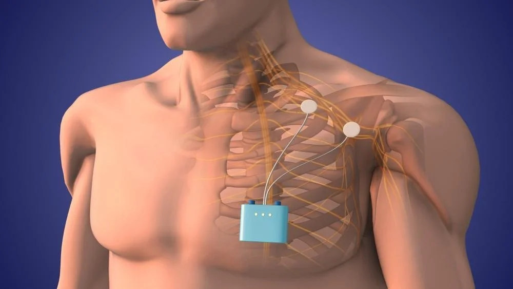 A New Treatment Option for CRPS Victims: Peripheral Nerve Stimulation</span>