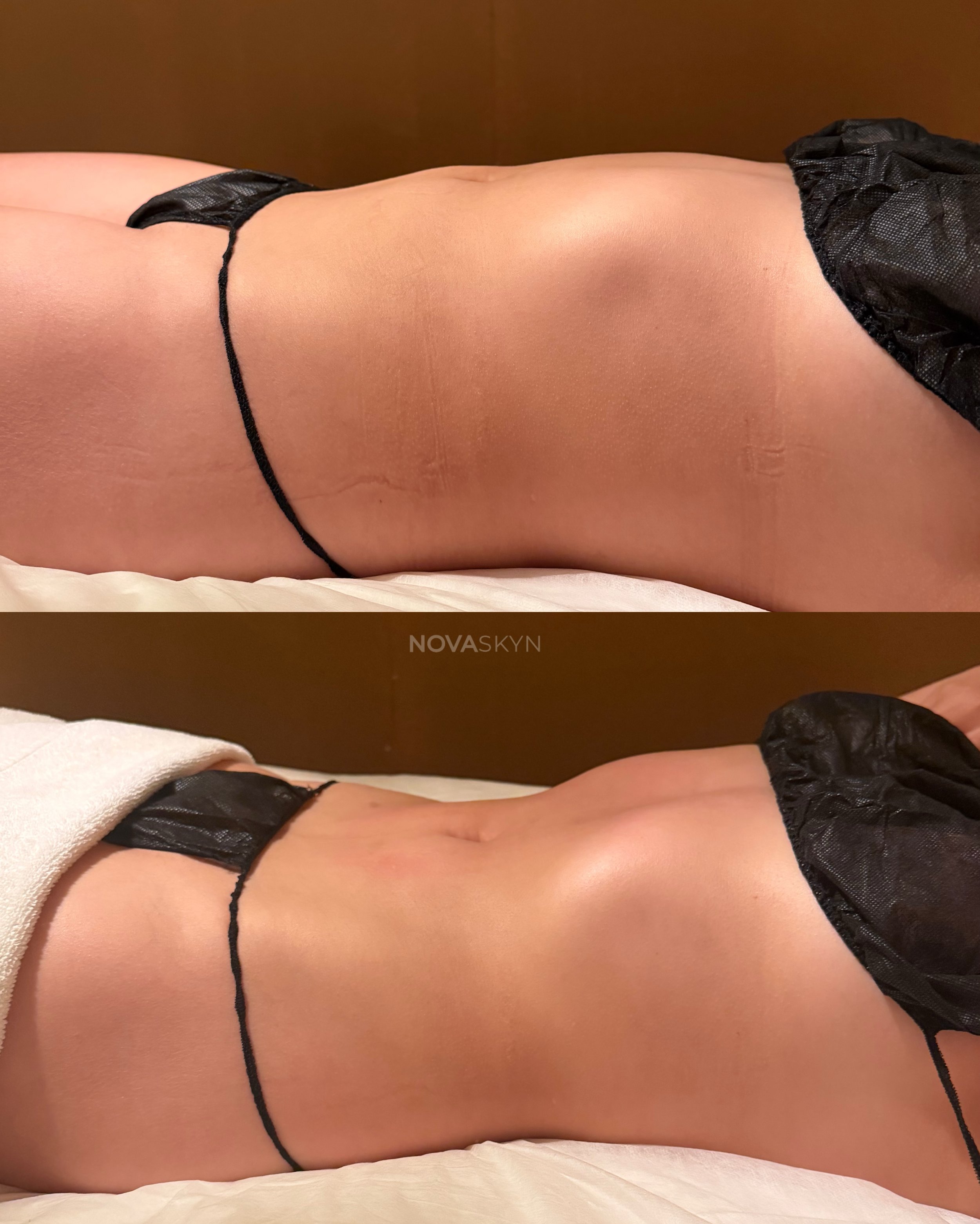 Original Novaskyn body-care comparison 2