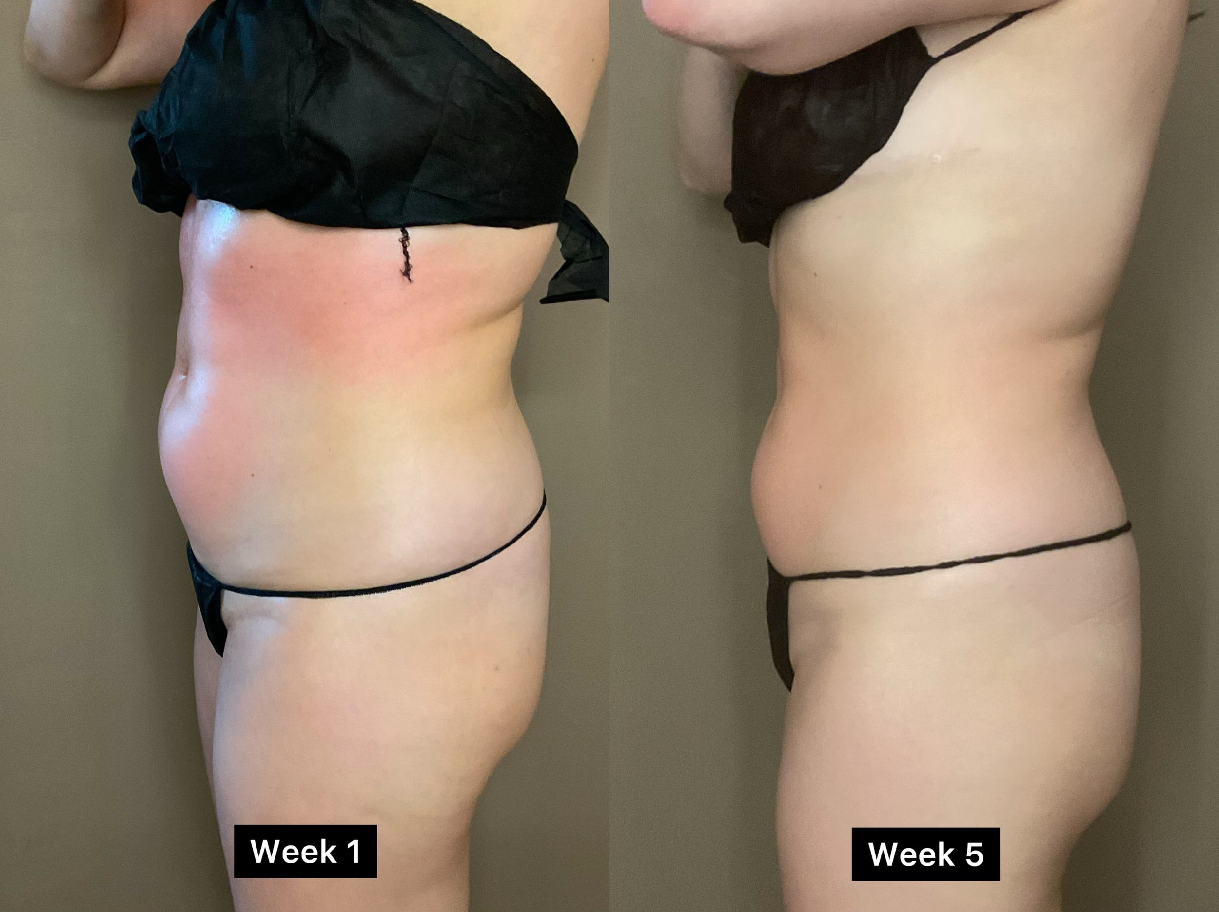 Original Novaskyn body-care comparison 3