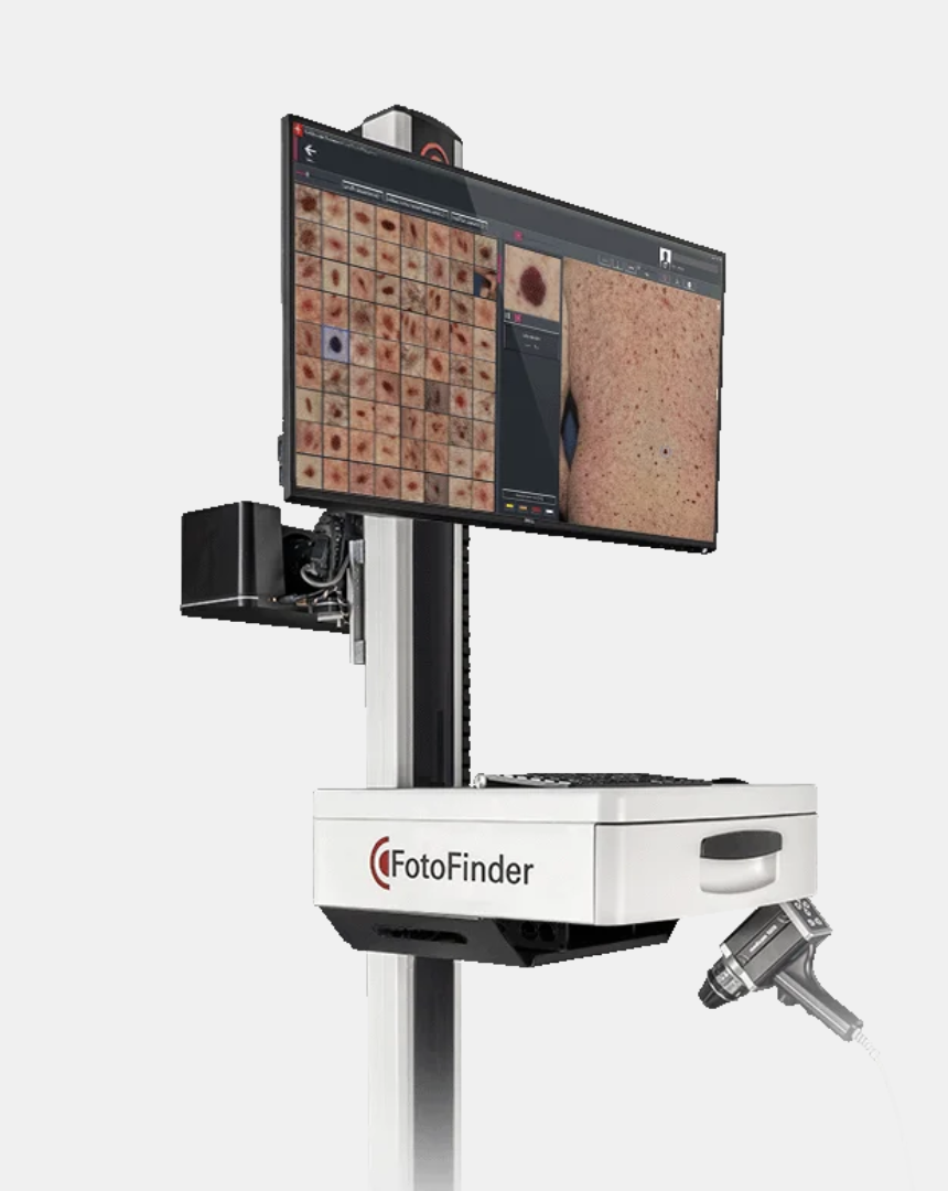 A medical imaging system called FotoFinder displaying close-up images of skin, including moles or other skin features, on a large monitor, along with a dermatoscope connected to the system.