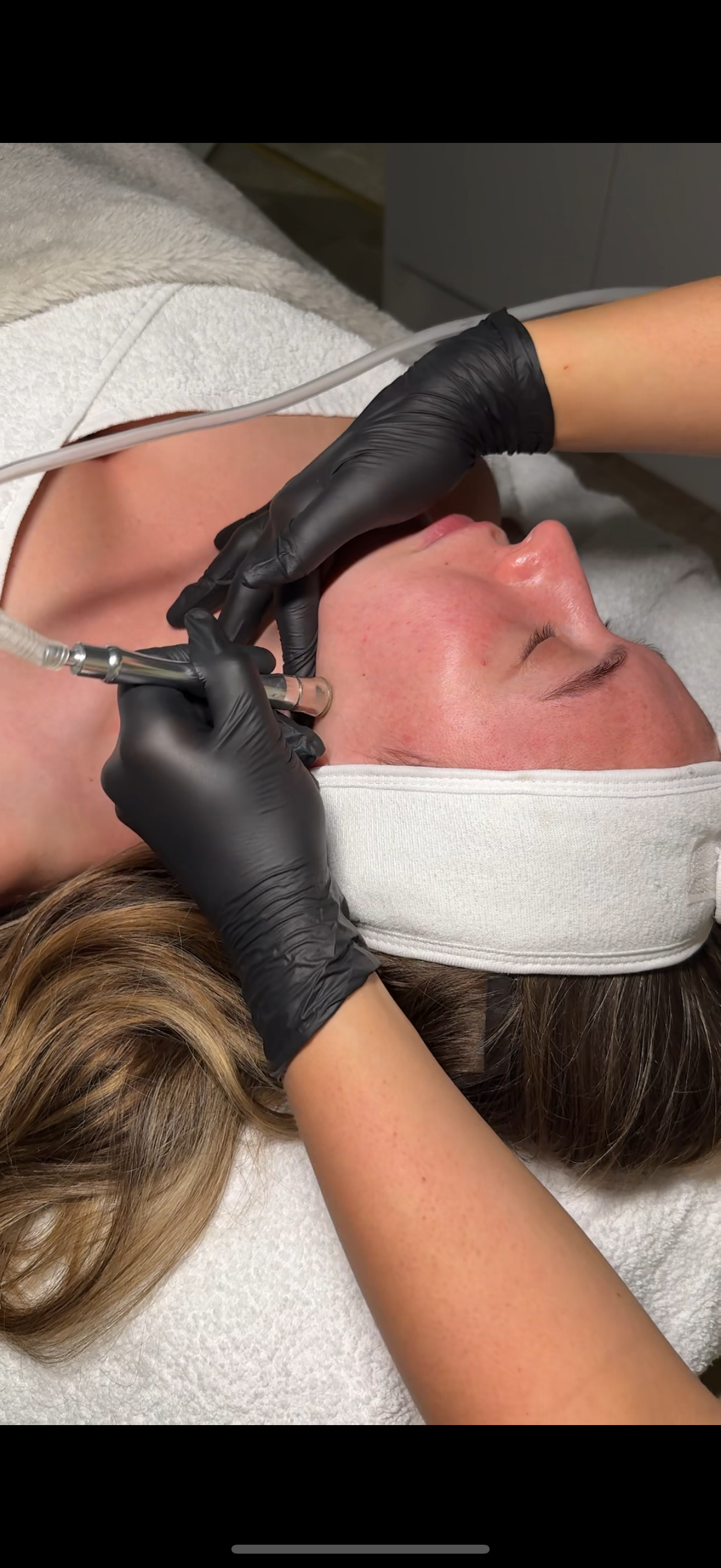 Skin treatment at Seven Skin Wirral clinic