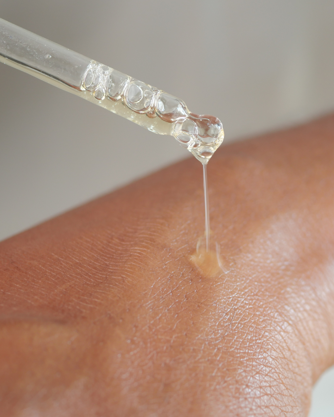 A dropper releasing a clear liquid onto skin.