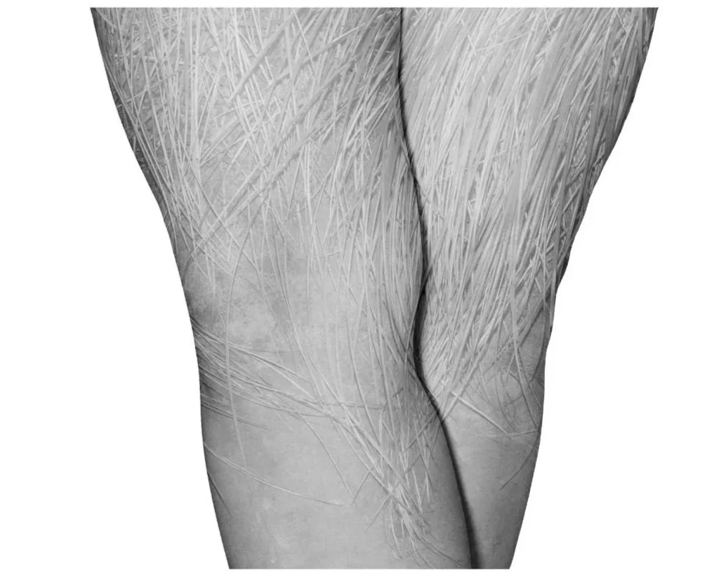 Close-up of a person's thighs, showing scratch marks and scars.