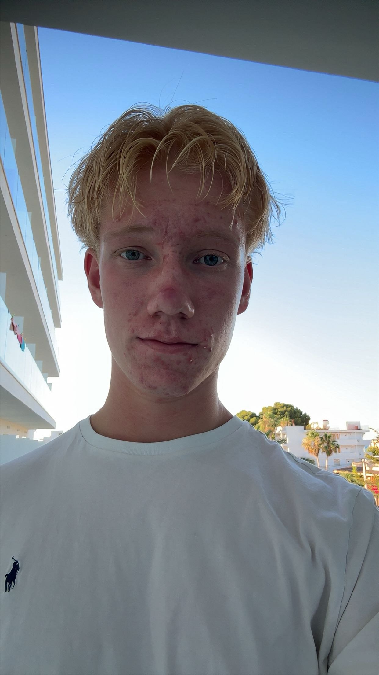Junge mit blonden, gewellten Haaren und heller Haut, trägt ein weißes T-Shirt, steht im Freien vor einem Gebäudekomplex bei Tag, blauer Himmel und einige Bäume im Hintergrund.