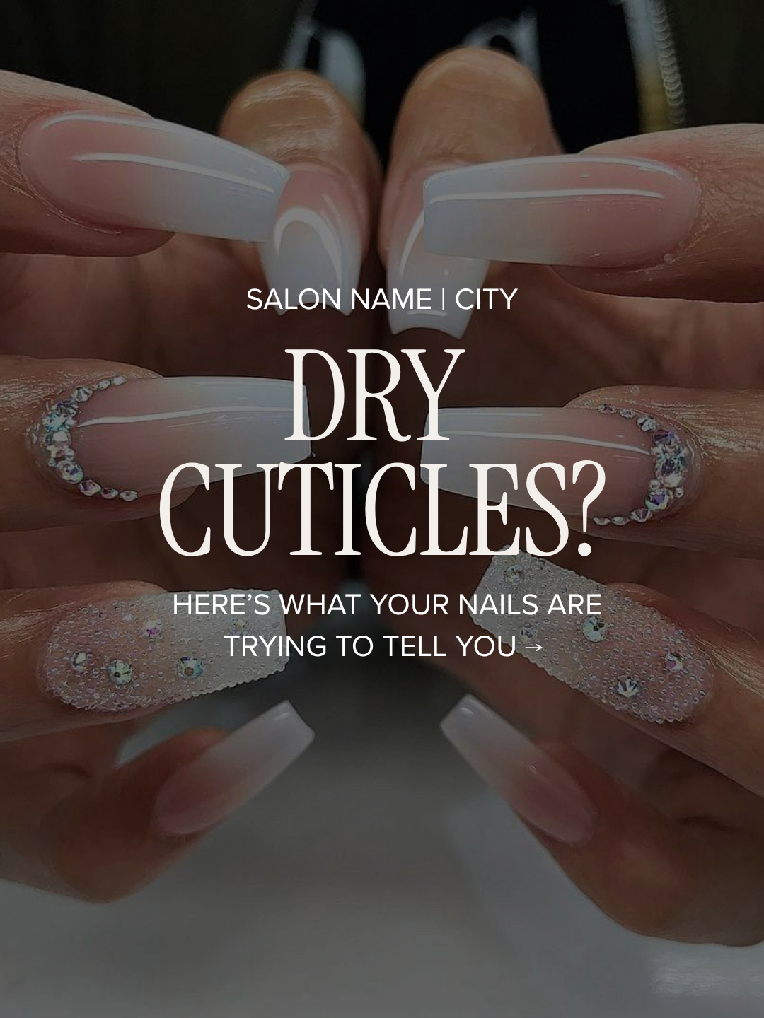 Dry cuticles?