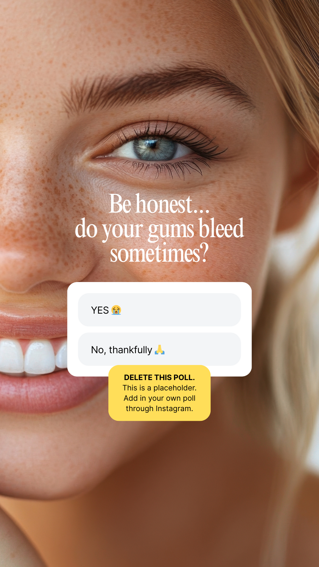 Gum bleeding