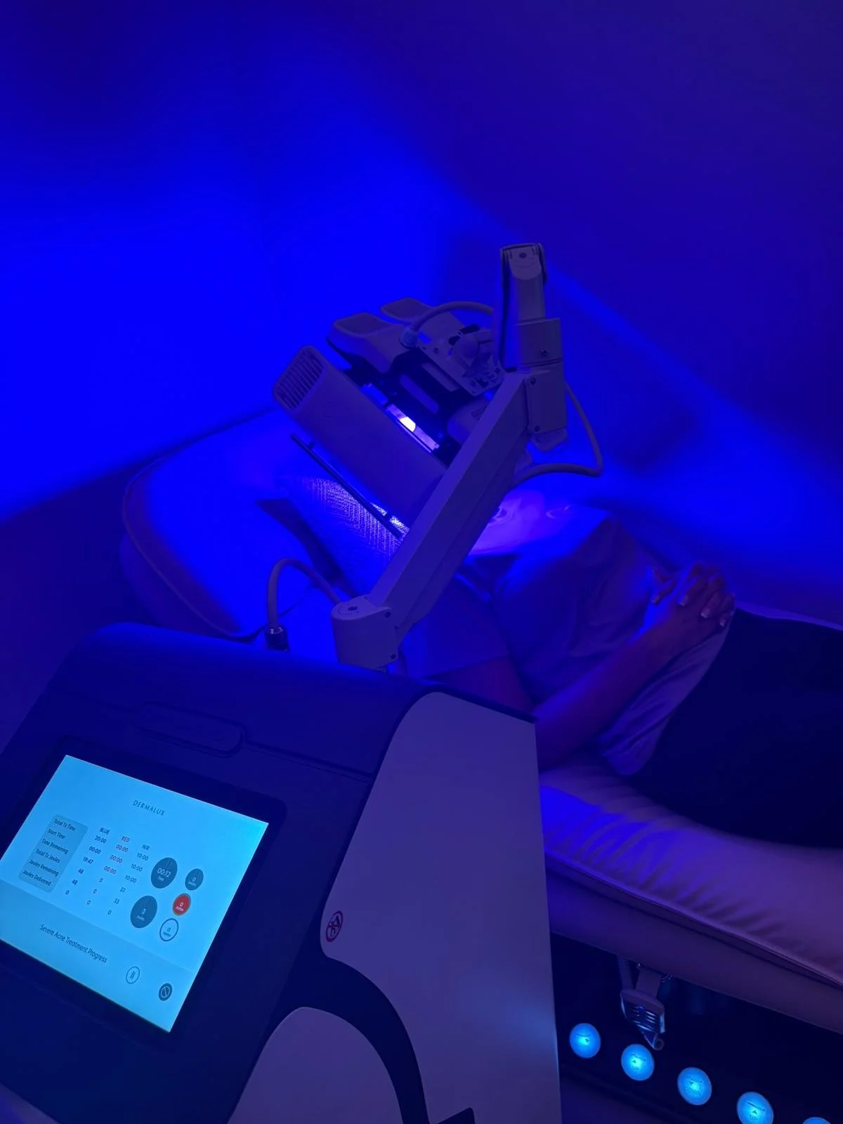 Medical device with a touchscreen monitor and a robotic arm positioned over a patient lying on a treatment table in a room illuminated with blue light.