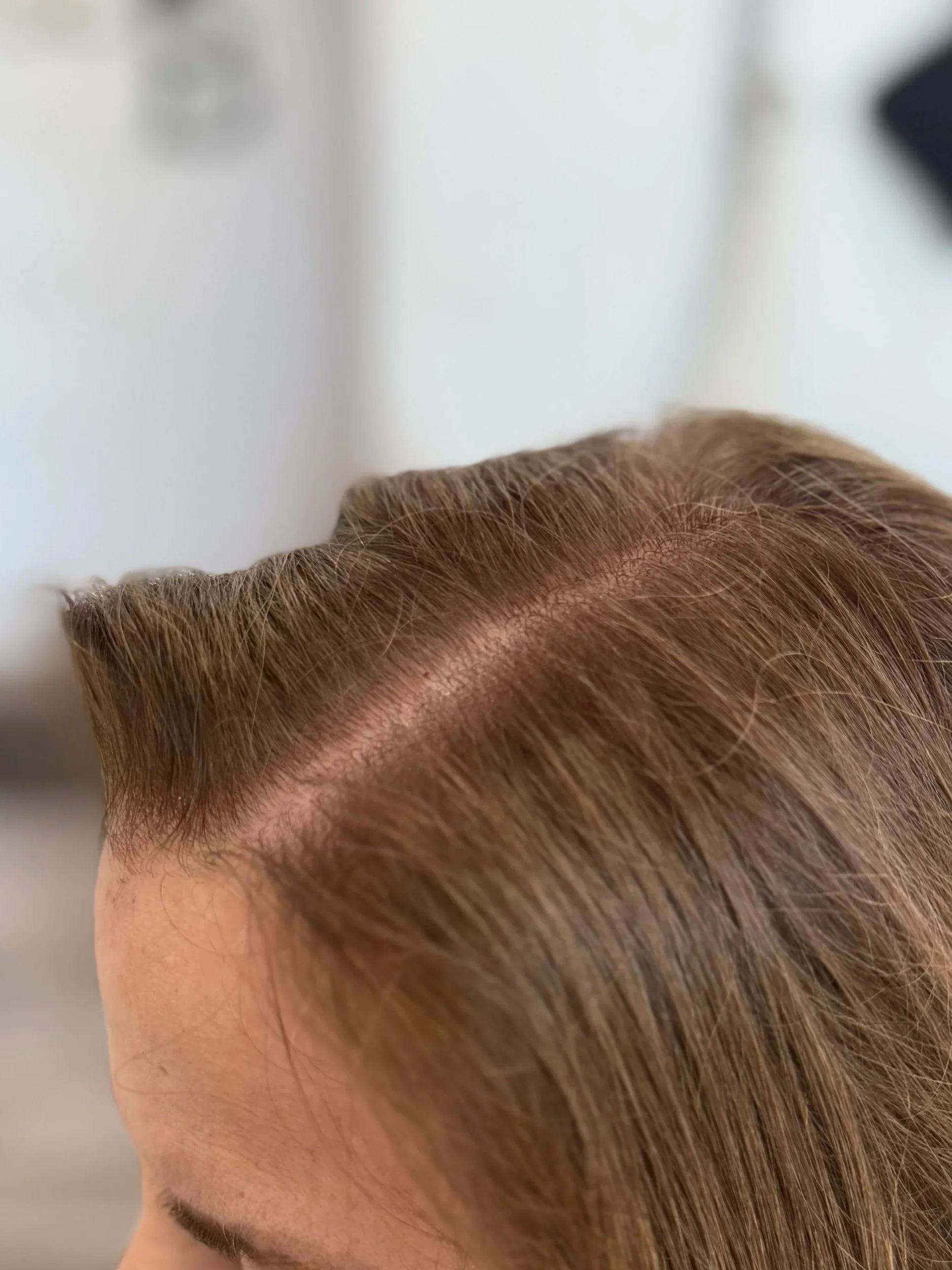 Close-up of a person with reddish-brown hair showing the scalp and part of the forehead with a blurred background.
