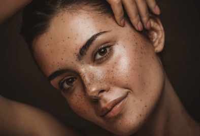 Close-up of a woman with freckles and dark hair, smiling gently