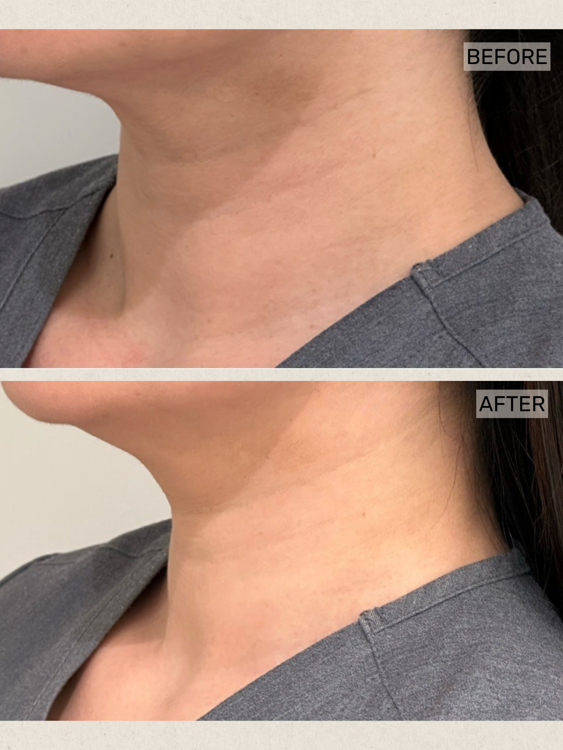 Skin Booster (2).png