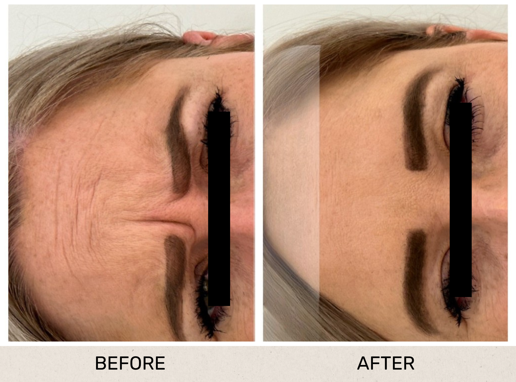 Anti Wrinkle.png