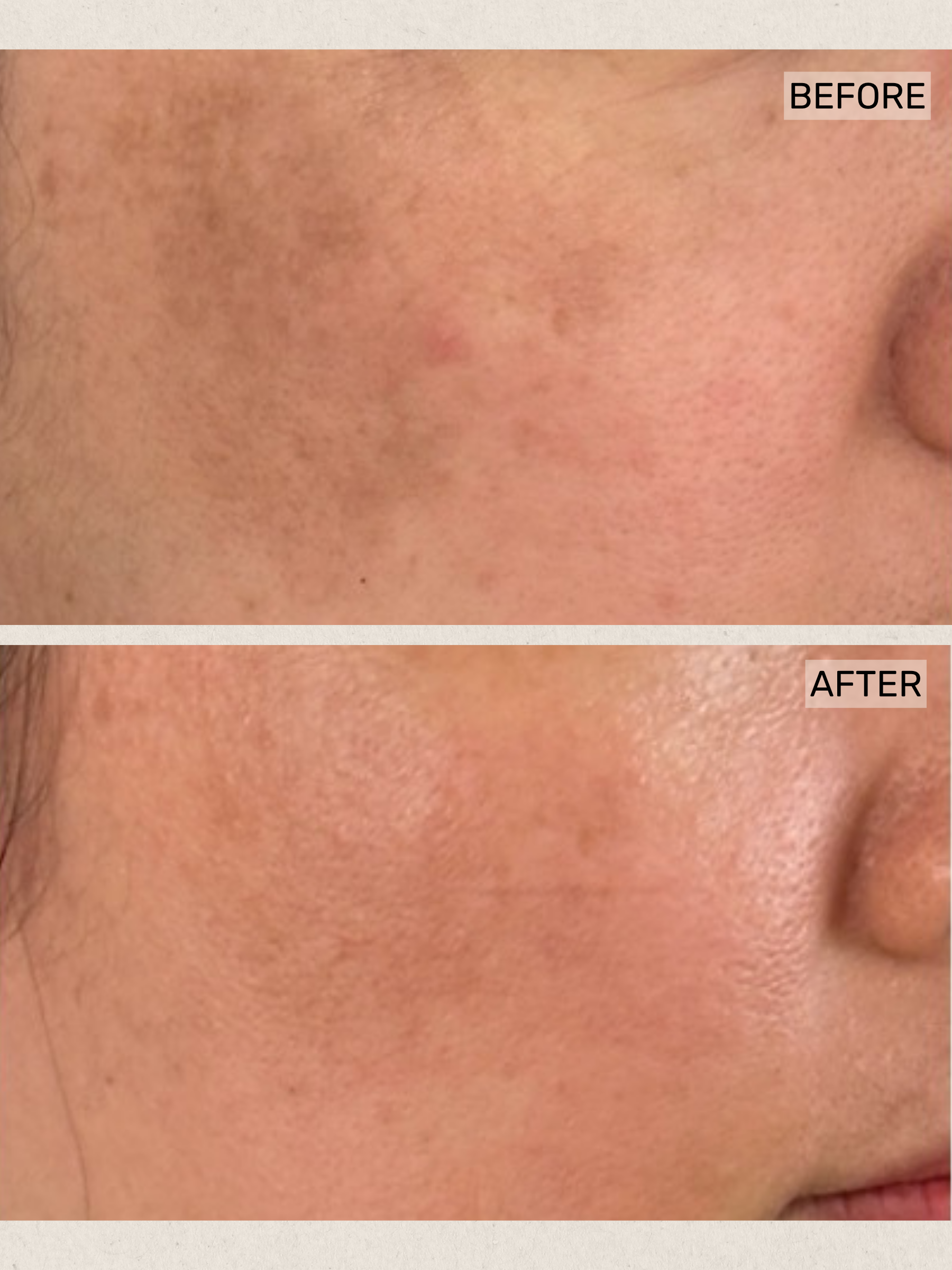 Skin Booster (3).png