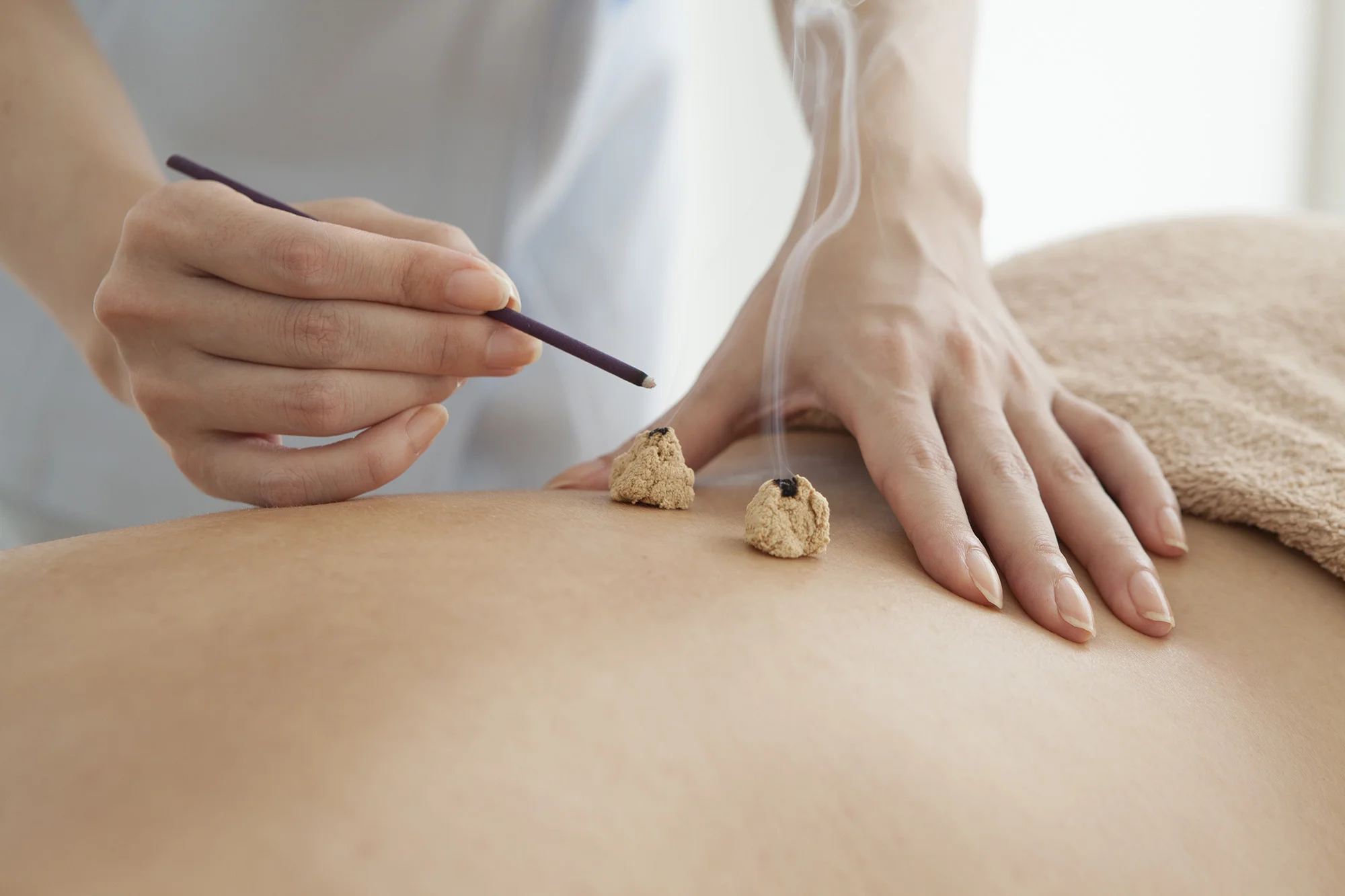 Moxibustion