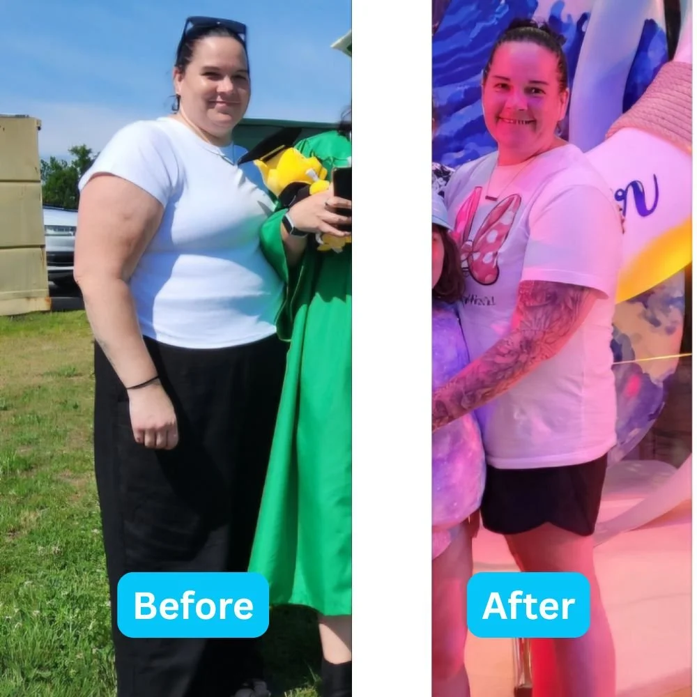 IndyCare Health patient who lost weigh as a part of the medical weight loss program.