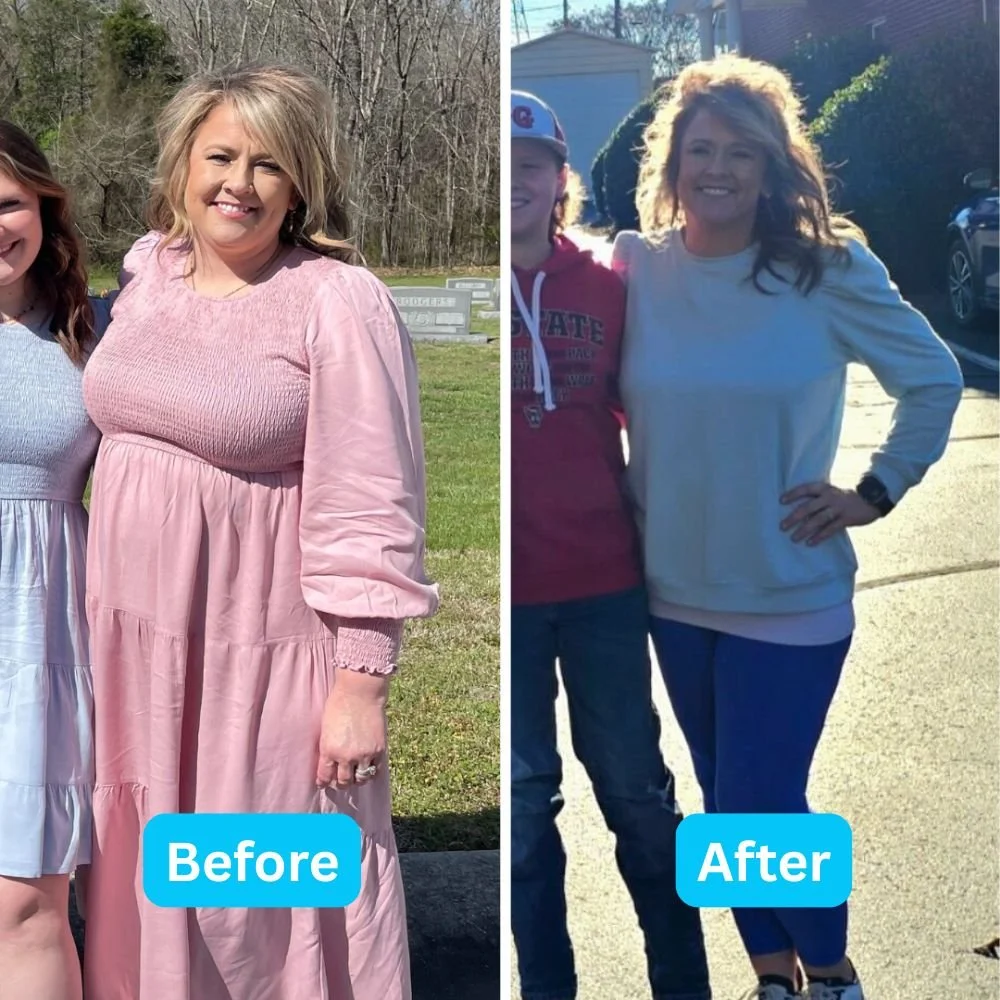 A before and after image of a weight loss patient at IndyCare Health.