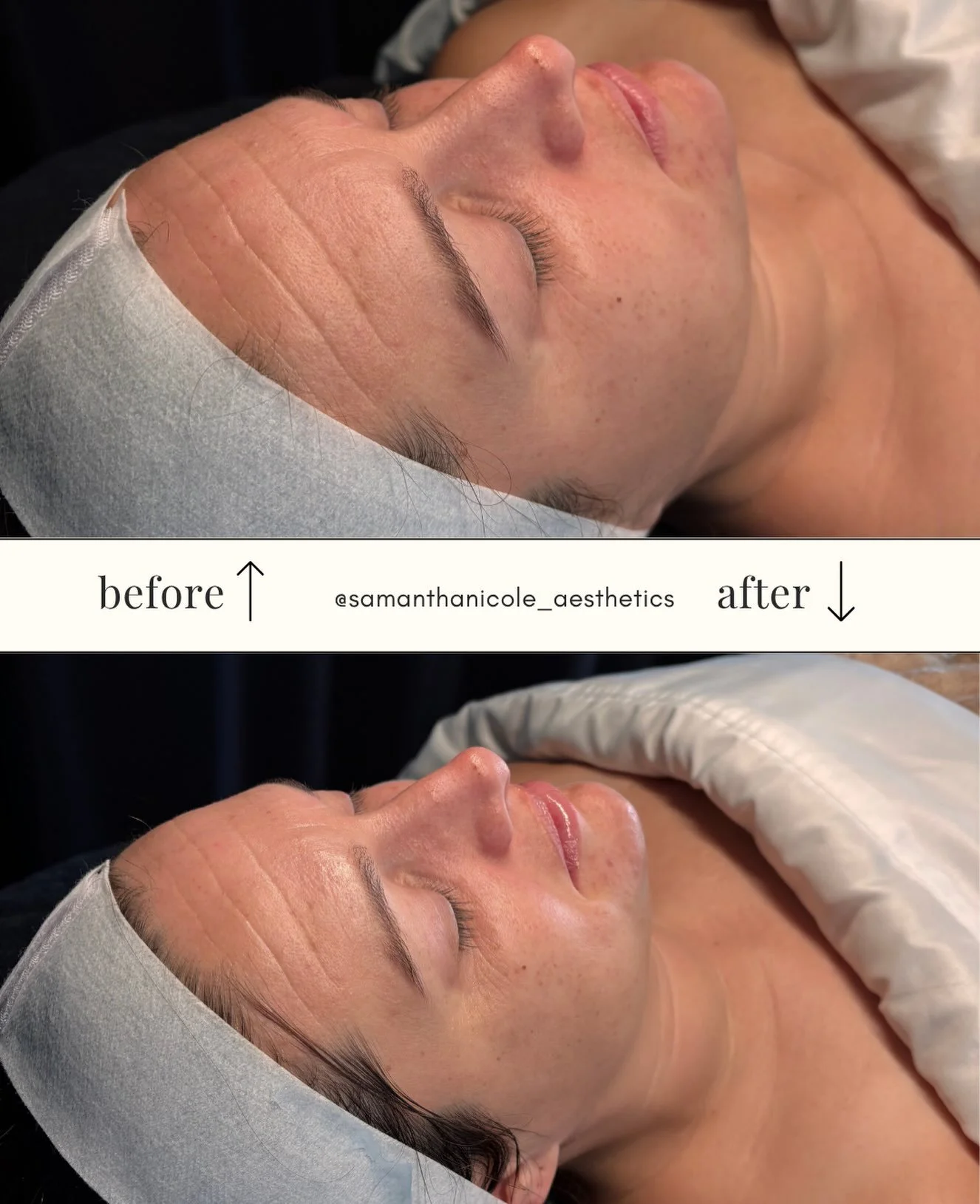 A beautiful glow speaks for itself.✨
Revitalized skin, enhanced with hydration, a touch of luminosity, and a naturally radiant finish.

Thoughtful skincare, personalized treatments, and attention to every detail &mdash; all coming together to bring o