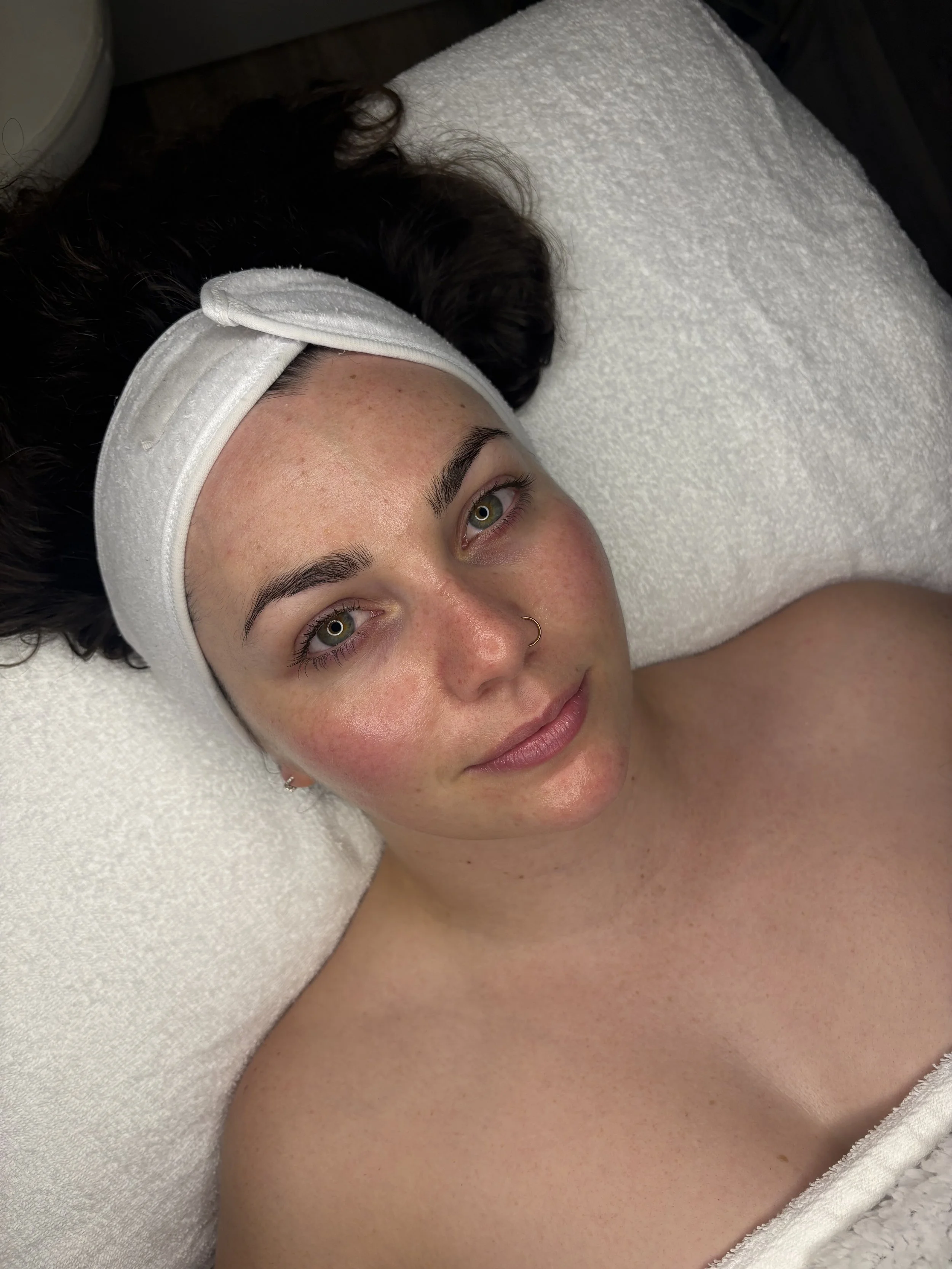 Close-up of a woman with light skin and green eyes lying down with her head resting on a white towel. She wears a white headband, and her face has some redness and freckles. She is partially covered with a white towel or blanket.