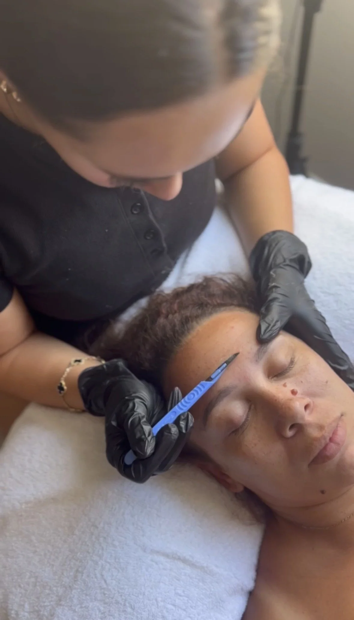 A person is lying down with eyes closed while another person, wearing black gloves, is performing a cosmetic procedure on their forehead using a blue pen-like tool. The person receiving the treatment has a beard and a slightly freckled face.