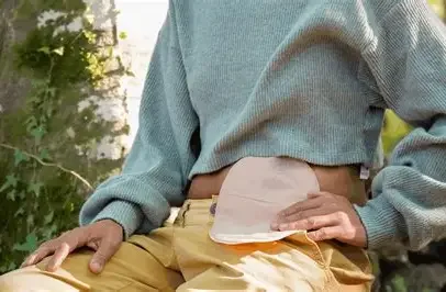 Client with a colostomy bag.  Certified Wound Ostomy Nuse CWON can help client with ostomy supplies and evaluation, troubleshooting, fitting, ostomy education and training.