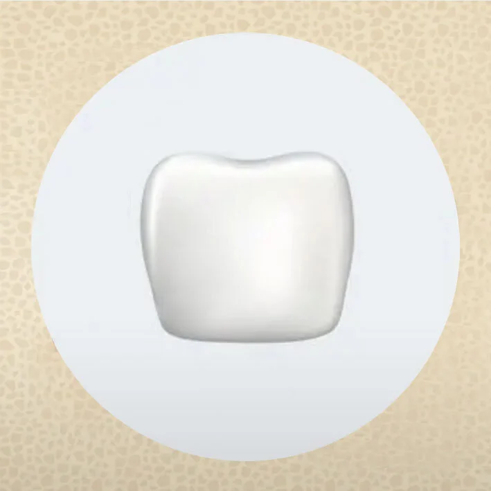 3. Implant crown.