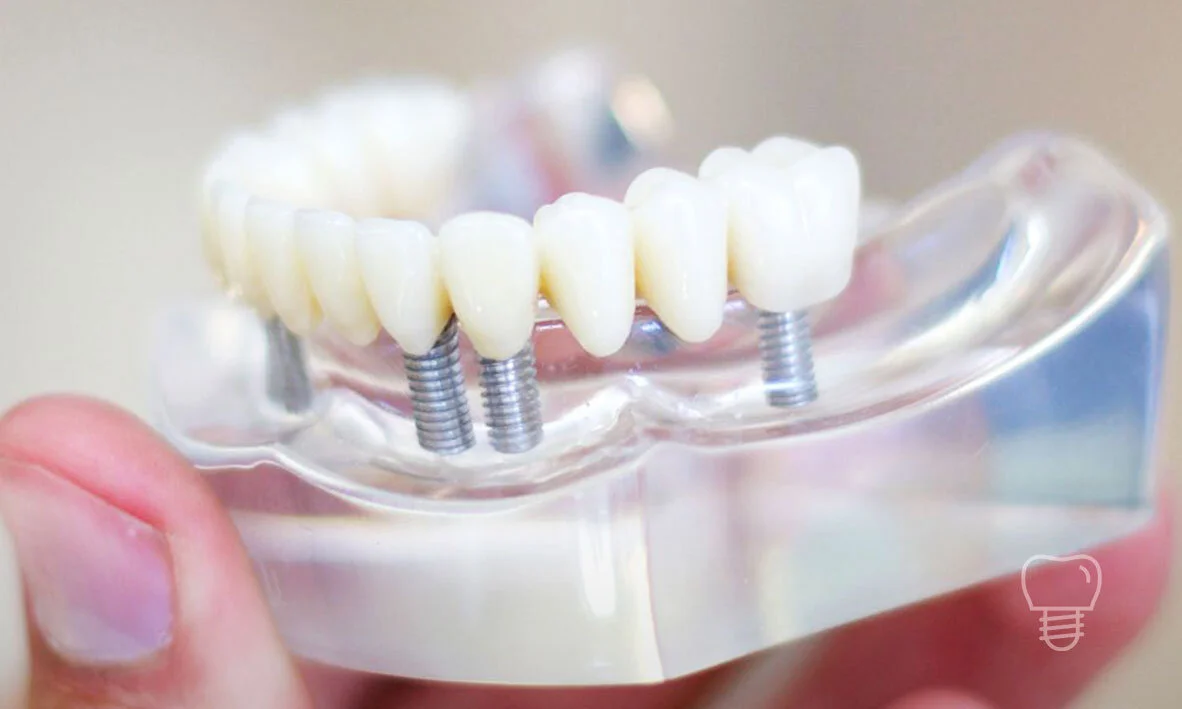 © Implant Dentist Sydney Our Dentists Why Us Advanced Implant Quality Technology.jpg