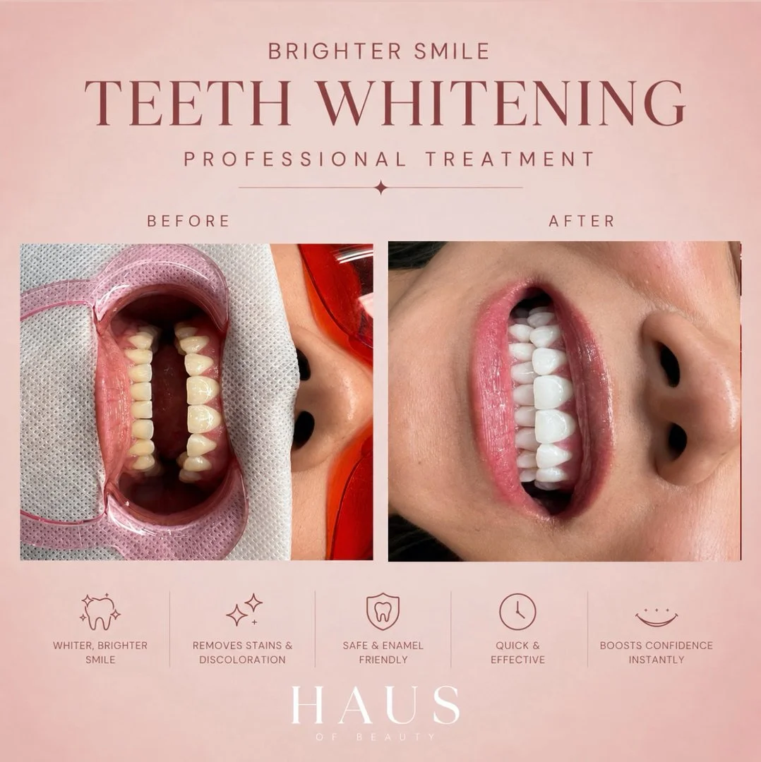 A brighter smile can lift your whole look. 😁✨

If you&rsquo;re in Waverley or nearby Bondi and Randwick, our professional teeth whitening is a simple way to freshen up your confidence for the end-of-winter catchups. At Haus Of Beauty, our experience