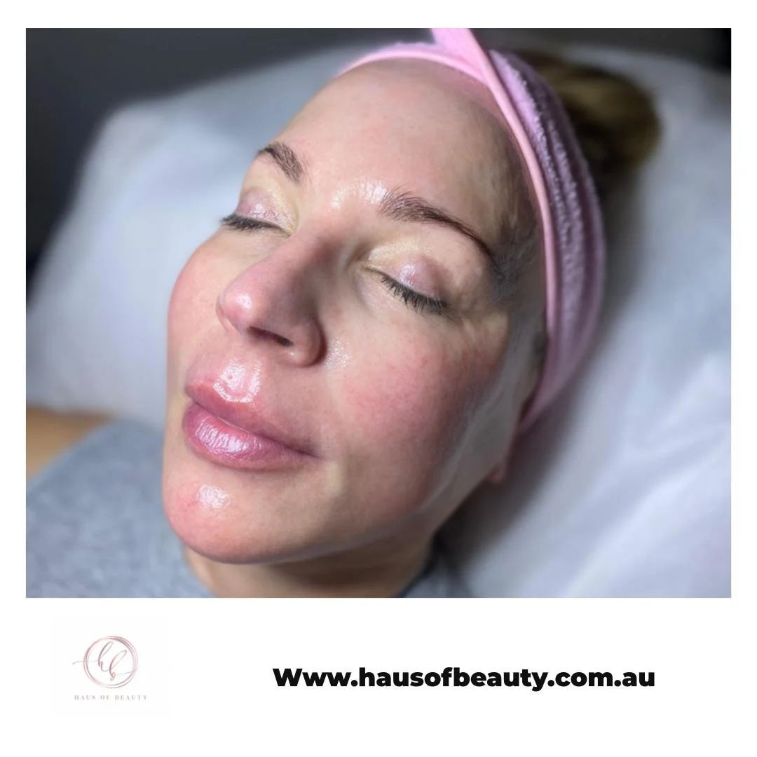 Give your skin a quiet reset this August. ✨ At Haus Of Beauty in Waverley, our experienced dermal therapists focus on results that still look natural, with the calm, luxury feel you want from a skin care clinic.

If texture, congestion, or early line