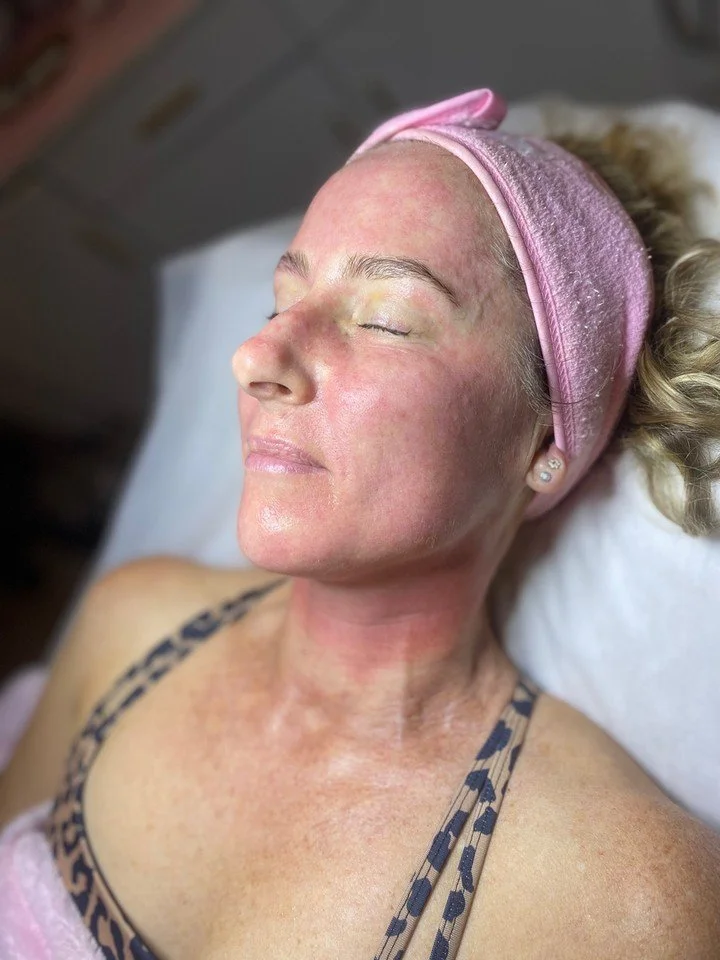 Spring is almost here, and your skin deserves a fresh start 🌸

Our dermal therapists at Haus Of Beauty in Waverley love helping clients achieve that smooth, lit-from-within glow. Treatments like microneedling Waverley and skin needling Bondi work be