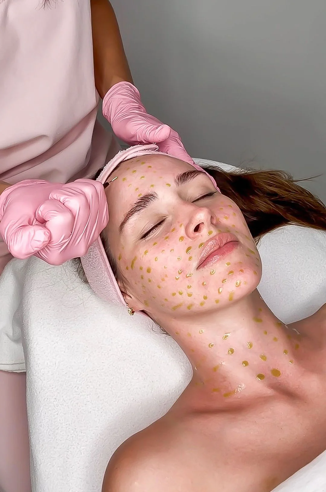 Your skin is telling you it's ready for something a little more advanced.

At Haus Of Beauty in Waverley, our experienced dermal therapists take a personalised approach to every skin treatment, beginning with a thorough consultation. Skin needling Bo