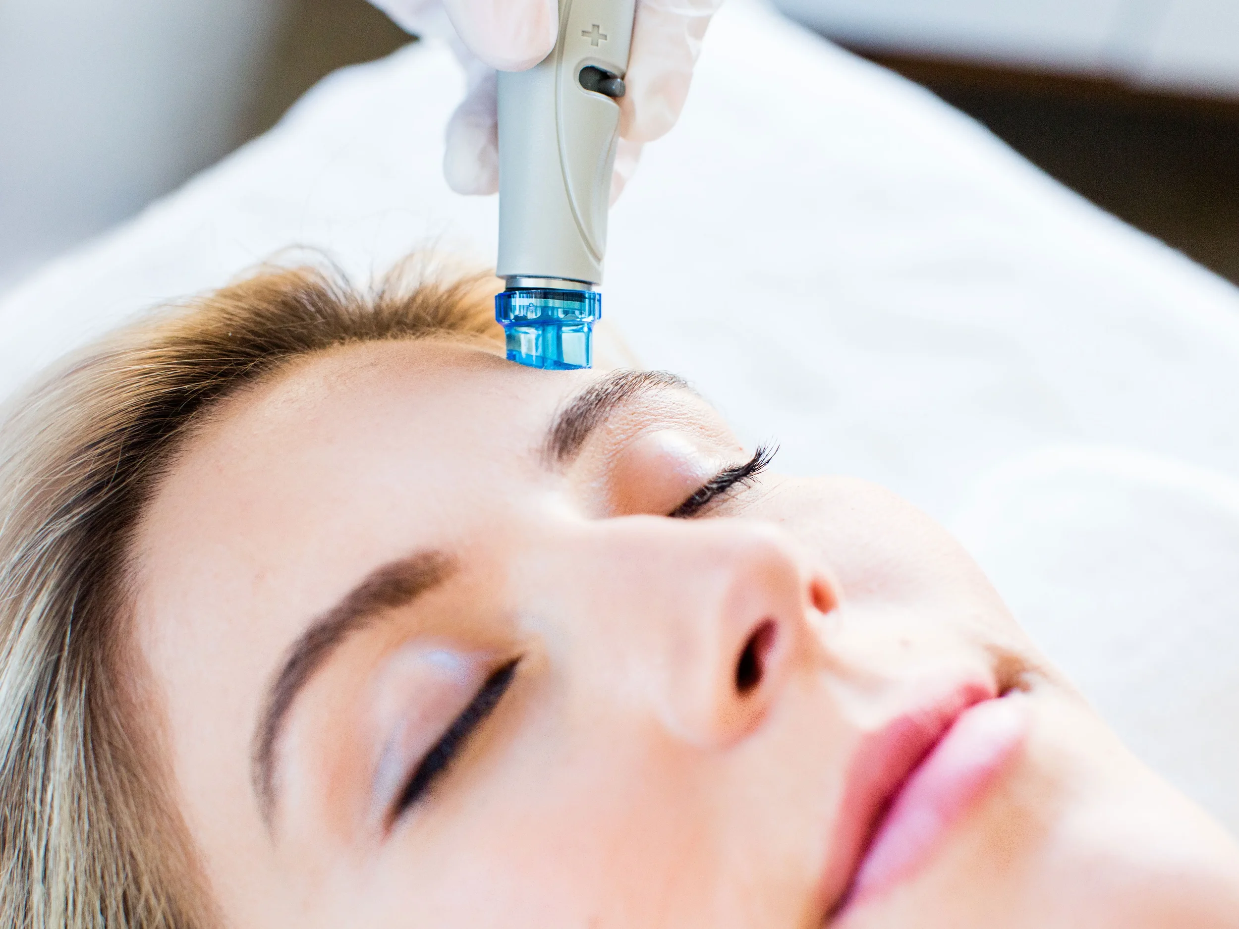 A person with blonde hair lying down with eyes closed, receiving a facial treatment with a small device applied to their forehead.