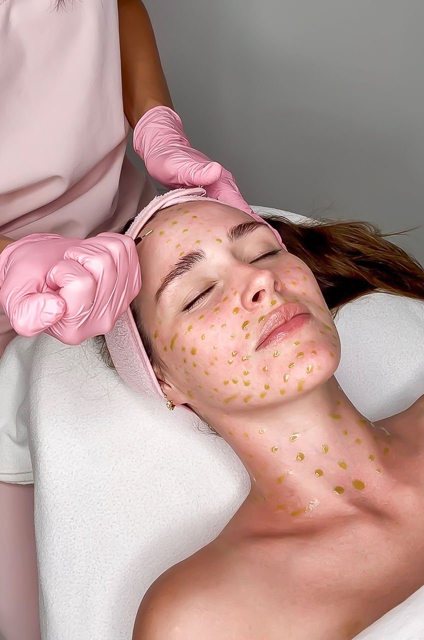 A woman is receiving a facial treatment at a spa or clinic, with her eyes closed and a relaxed expression. Gold spots are applied to her face and neck. A skincare professional wearing pink gloves is gently working on her forehead.