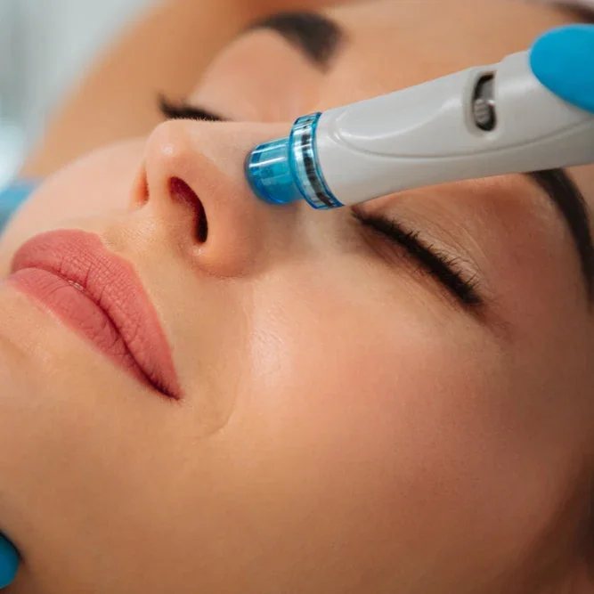 Close-up of a woman receiving a cosmetic facial treatment with a pen-like device applied to her nose, lying on her back with eyes closed.