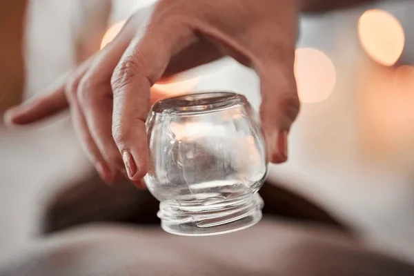 Acupuncture + Cupping