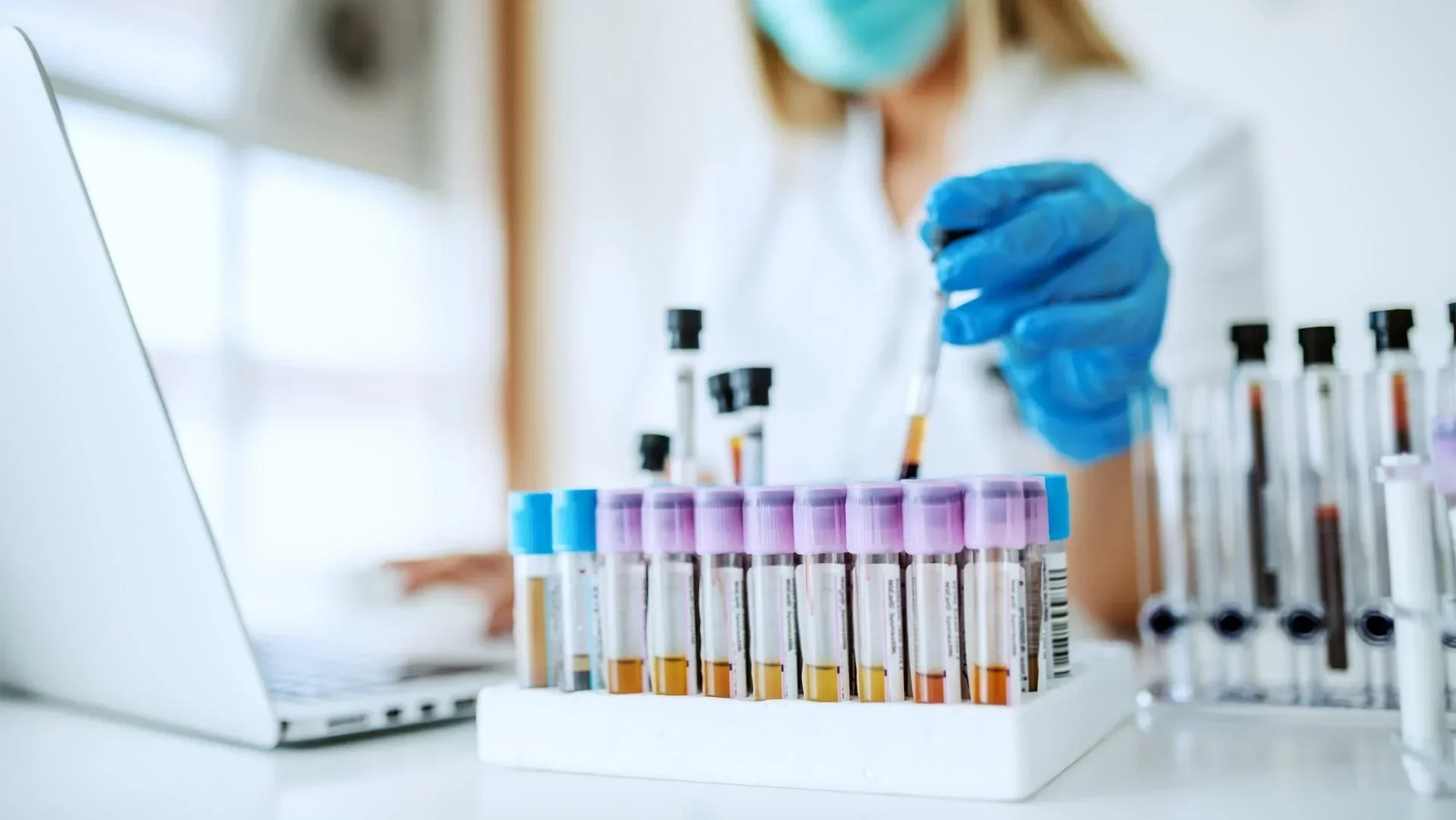 A scientist wearing blue gloves is working with test tubes filled with various colored liquids in a laboratory setting. Some test tubes are capped with purple lids, and they are organized in a rack. Additional test tubes with black caps are visible in the background.