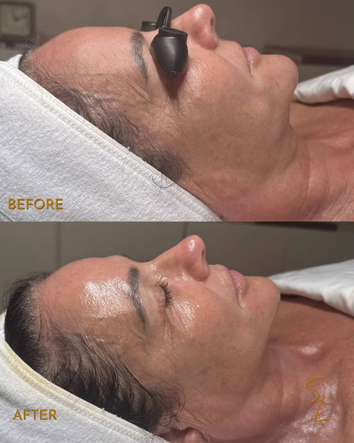 Spring is back and so am I! I am looking forward to continuing to make y&rsquo;all giggle and glow. Link in bio🔗
.
What to book: The Sculpt + Lift
Results: Sculpt up to 2 weeks, Glow: up to a month.
*aftercare dependent*
Service time: 1 hour
Price: 