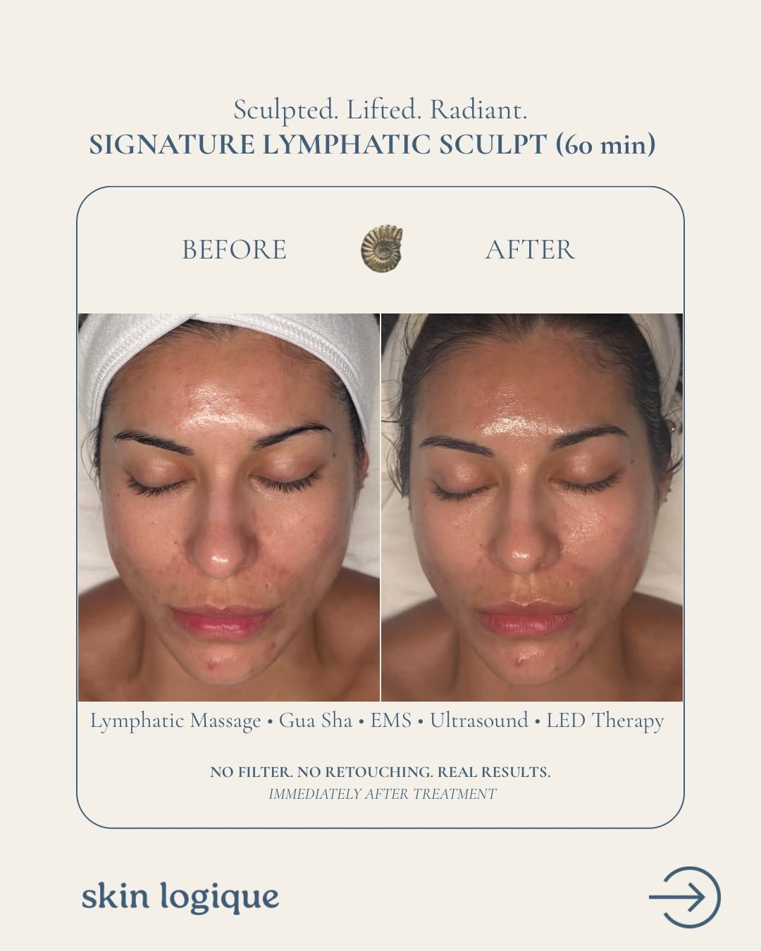 Facial massage encourages circulation and lymphatic flow. This increases the skins oxygen up to 400%. 
.
This means ✨undeniable glow ✨reduced inflammation ✨detox support ✨collagen production ✨facial muscle tension relief ✨healthy aging
.
Book your Si