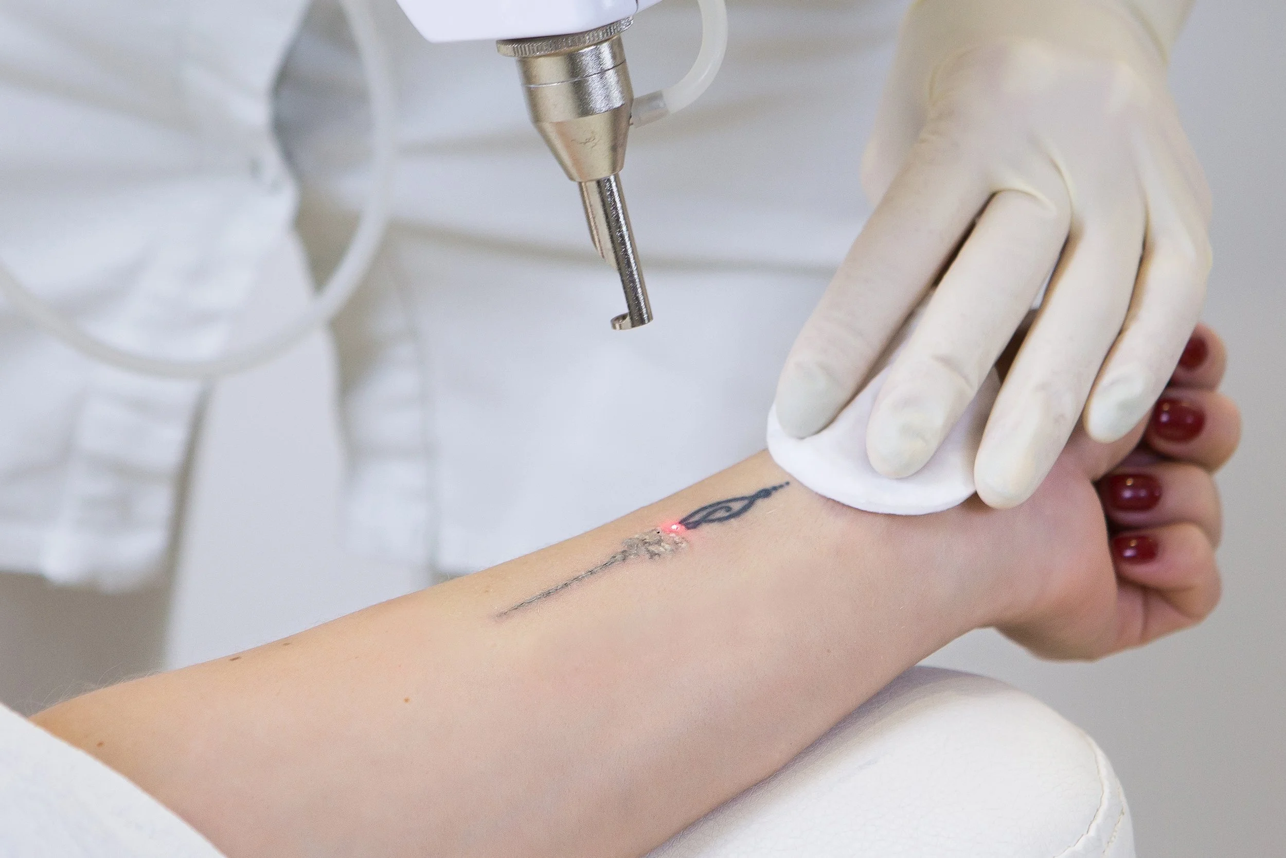A person with red nail polish is receiving a tattoo on their forearm. The tattoo shows a small, minimalistic design. The tattoo artist, wearing a white glove, is using a tattoo machine to create the design.