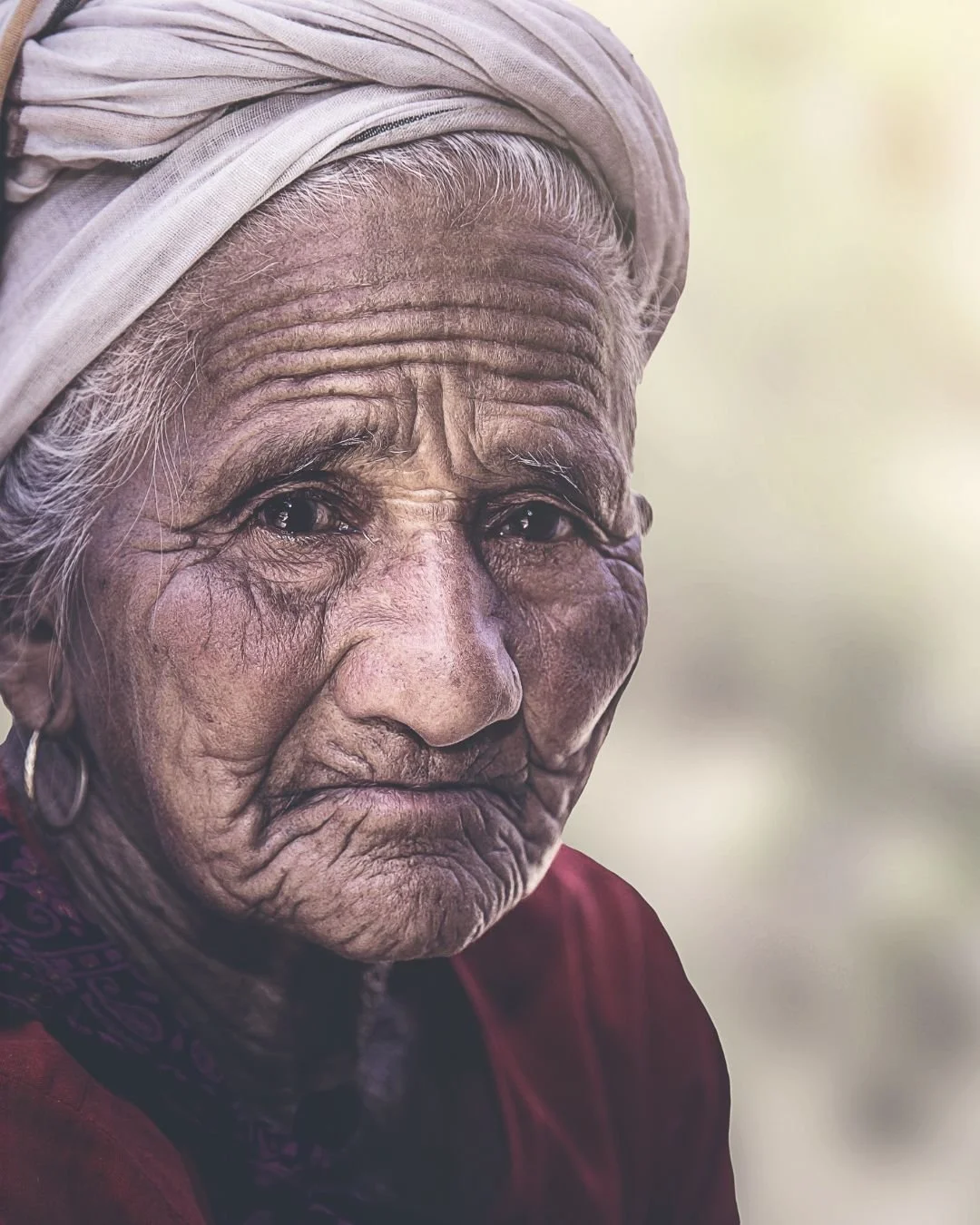  What Happens If You Stop Having Anti-Wrinkle Treatments …