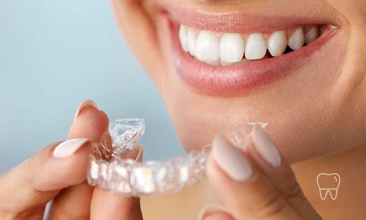 © Clear Braces Dentist Sydney Invisalign Clear Braces 03.jpg